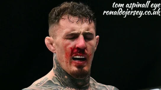 tom aspinall eye