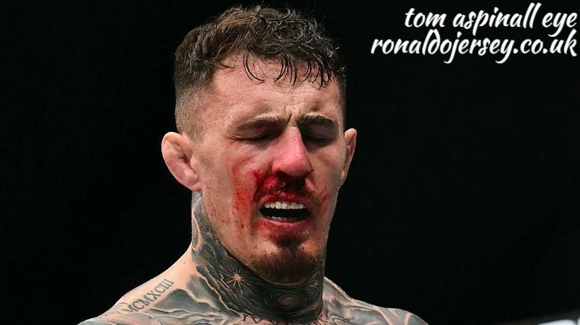 tom aspinall eye